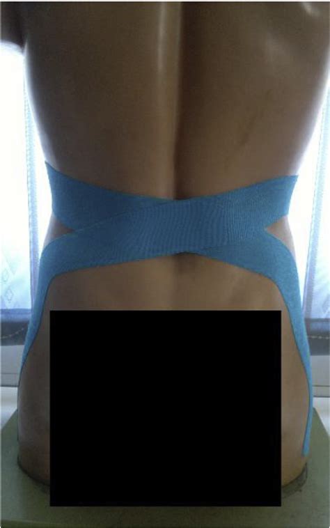 Figure 1 From The Effect Of Kinesio Taping On Postural Control In