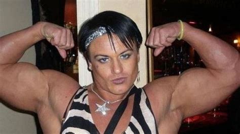 Steroid Abuse Had Some Negative Side Effects On This Woman Others