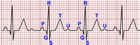 Generalidades Del Electrocardiograma 34560 The Best Porn Website