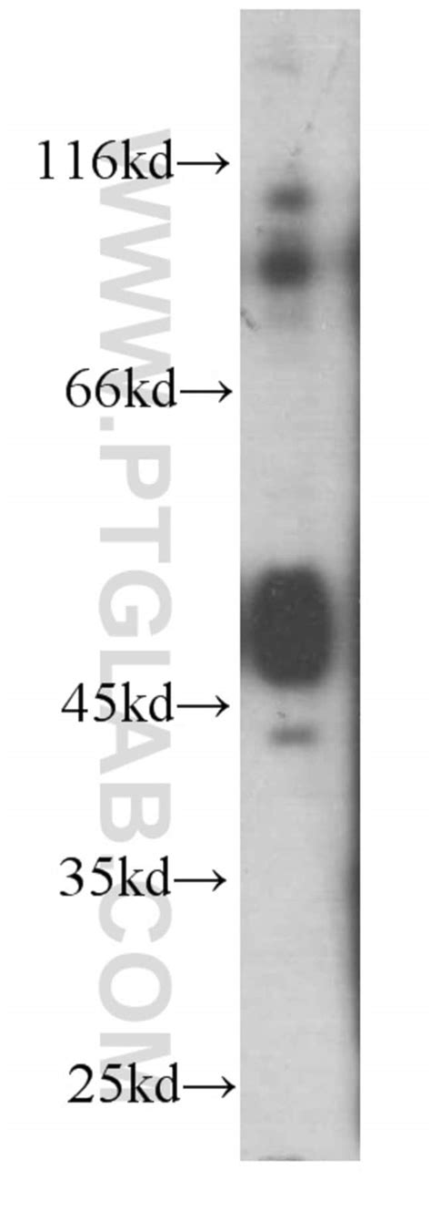 Tnfr1 Mouse Anti Human Mouse Porcine Rat Clone 2a6e3 Proteintech