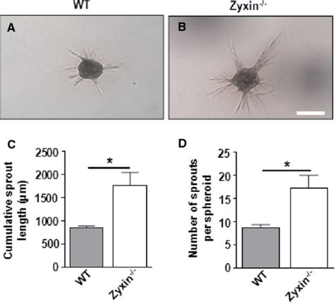 Zyxin‐null Vsmcs Display Enhanced Invasion In A 3d Collagen Gel Download Scientific Diagram