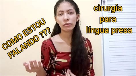 COMO ESTÁ MINHA FALA DEPOIS DE 2 ANOS DA CIRURGIA NA LÍNGUA PIOROU OU