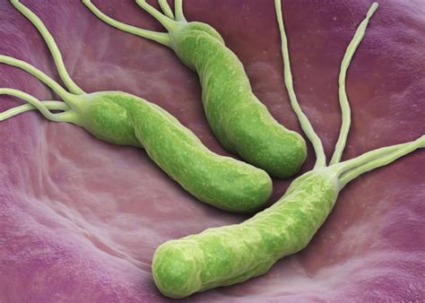 Bakteria Helicobacter pylori jak dochodzi do infekcji skutki zakażenia