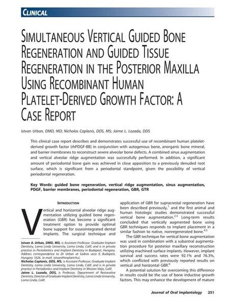 “pass” Principles For Predictable Bone Regeneration