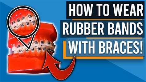 How To Wear Rubber Bands Elastics With Braces Youtube