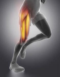 Quadriceps Muscle Strain Treatment