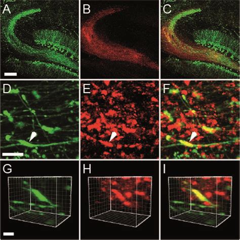 Acute Hippocampal Slices Of Adult Mice Thy1 Egfp Line M Transgenic