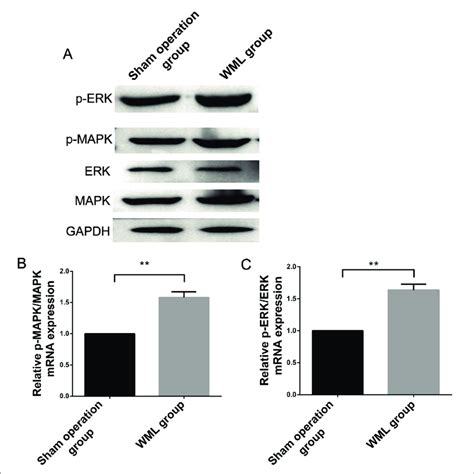 The Mapkerk Pathway Is Activated In The Case Of Wml A Compared With