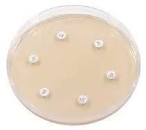 Mueller Hinton Agar Mha Composition Preparation Uses Microbe Online