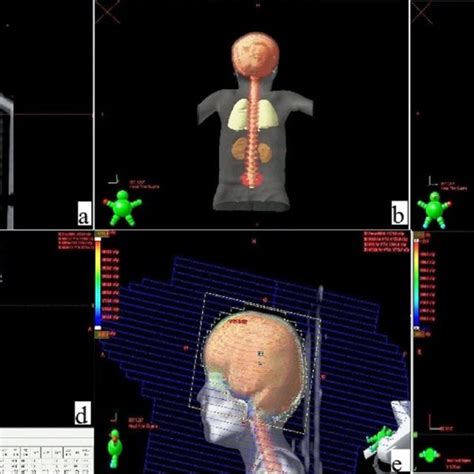 A B C Planning Target Volume PTV Encompassing The Clinical Target