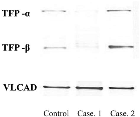 Western Blot Analysis Of Mitochondrial Trifunctional Protein In The