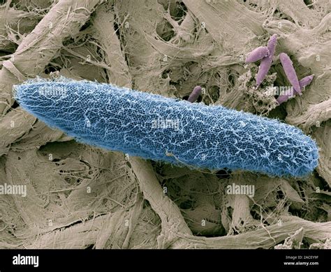 Paramecium Protozoan Coloured Scanning Electron Micrograph Sem Paramecia Are A Group Of