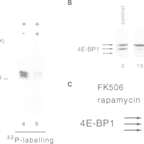 Rapamycin Blocks The Phosphorylation Of E Bpi Nih T Cells Were