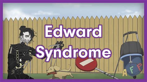 Edward Syndrome Trisomy 18 Usmle Step 1 Mnemonic Youtube