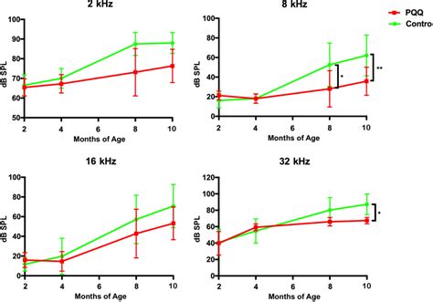 Abr Thresholds In The Age Related Hearing Loss Model Abr Thresholds Of