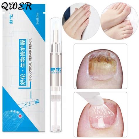 1PC 3ML Fungal Nails Treatment Pen Onychomycosis Paronychia Anti Fungal