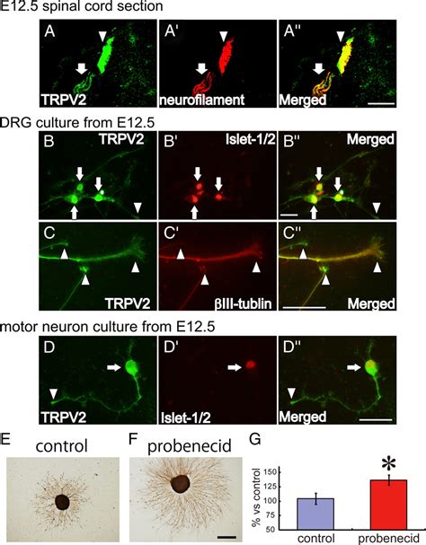 Trpv2 Enhances Axon Outgrowth Through Its Activation By Membrane