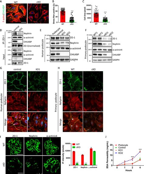 Depletion Of Chilkbp Leads To Podocyte Dysfunction A Representative