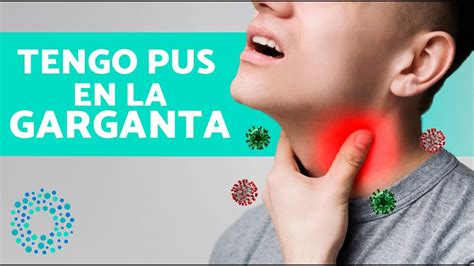 Por Qu Sale Pus En La Garganta Infecci N En Garganta Con Pus