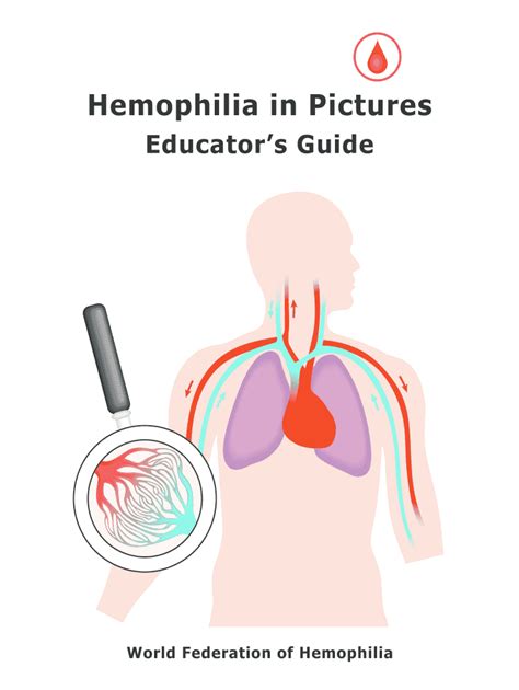 Fillable Online Hemophilia In Pictures Fax Email Print Pdffiller