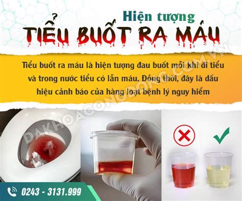 6 bệnh lý nguy hiểm gây hiện tượng tiểu buốt ra máu ở nam giới Phòng