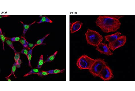 Androgen Receptor (D6F11) XP® Rabbit mAb (Alexa Fluor® 488 Conjugate ...