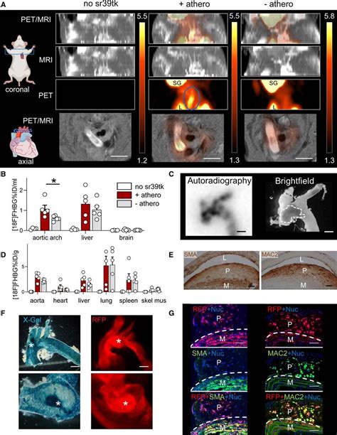 N Vivo Positron Emission Tomography Pet Magnetic Resonance Imaging