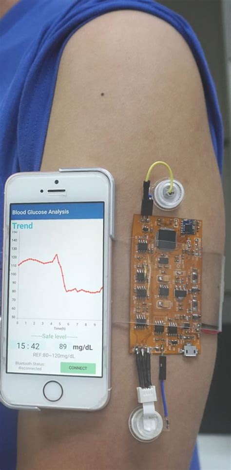 EMail schreiben Säule Süd blood glucose monitor patch Lüster Blauwal ...