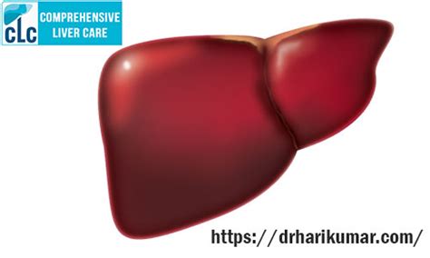 How To Treat Liver Disease Liver Specialist Doctor In Kerala