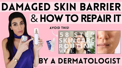 Damaged Skin Barrier And How To Repair It Dermatologist Deep Dive Go IT