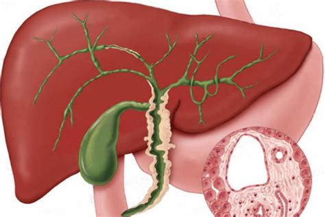 Stage 4 Liver Cancer Life Expectancy - CancerOz