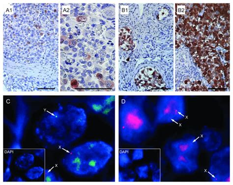 In Situ Expression Pattern Of Germ Cell Related Markers Mage A4 And