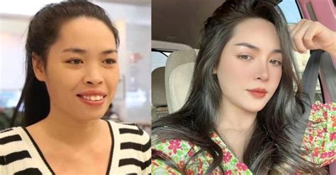 Hot Girl Dao K O V Thanh Qu Nh Ng N Khi Vi C Ch Nh S A Nhan S C Qua N M V N B O L I