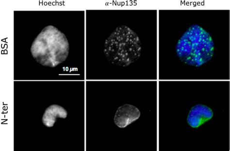 Figure 1 From Role Of Nuclear Envelope Protein Man1 In Nuclear Organisation And Maintenance Of