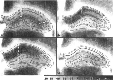 Frontal sections of the rat brain dorsal hippocampus at the level ... 