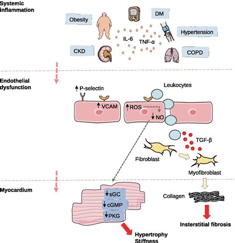 Proposed Mechanisms Underlying Myocardial Dysfunction And Stiffness In