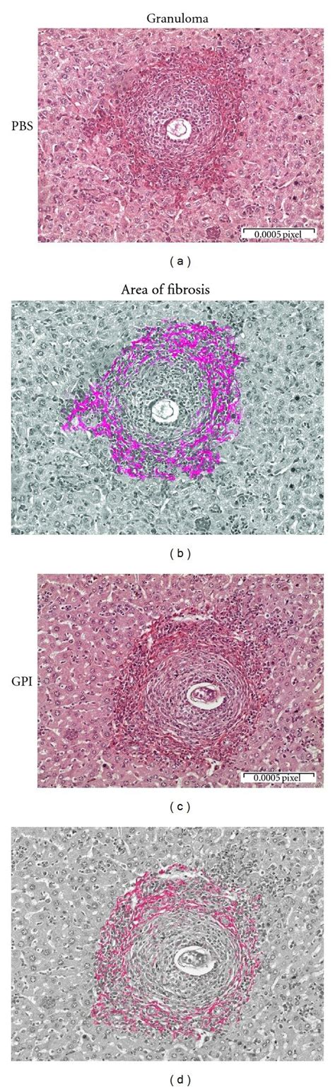 Histological Analysis Of Hepatic Tissue From Mice Vaccinated With Download Scientific Diagram