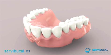 Todo Lo Que Necesitas Saber Sobre Las Pr Tesis Dentales Removibles