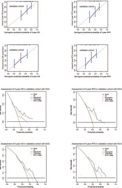 Figure S4 Calibration Curves And Decision Curve Analysis For HCC