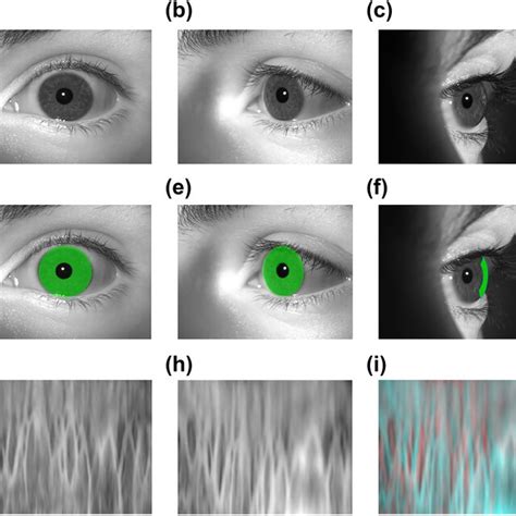 Examples Of The Iris Images In The Dataset And The Corresponding