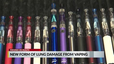 Researchers New Form Of Lung Damage From Vaping Products Youtube