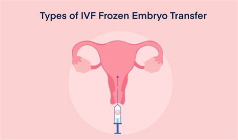 Ivf Frozen Embryo Transfer Timeline Process Pregnancy Test