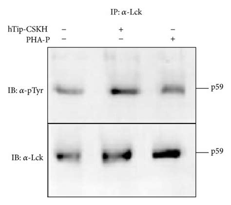 Time Course Assay For Lck In Human Pbmc After Cell Stimulation A