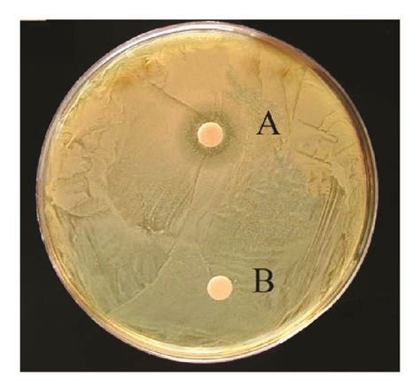 Disc Diffusion Assay Cl Of E Sepositus Against Staphylococcus Aureus Download Scientific