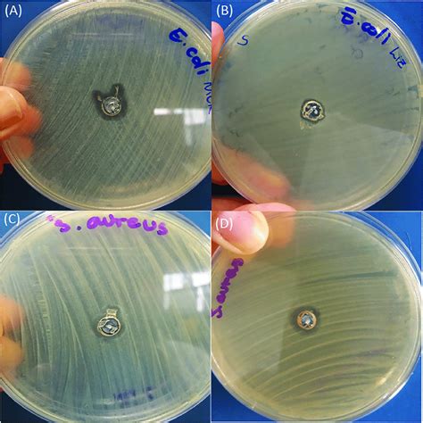 Bactericidal effect on E. coli. (A) Ag-NPs (Q), (B) Ag-NPs (M) and on... | Download Scientific ...