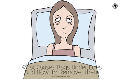 What Causes Bags Under Eyes and How to Remove Them