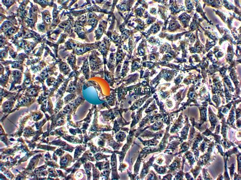 Es 2细胞 细胞株 人卵巢透明细胞癌细胞 中乔新舟生物科技有限公司