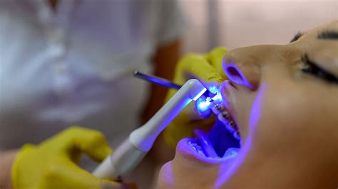 Dental Lasers The Dental And Denture Care Center Spring Hill Fl