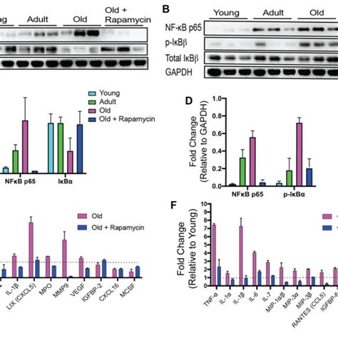 Rapamycin Alters Increased NF KB Expression And Inflammatory Cytokine