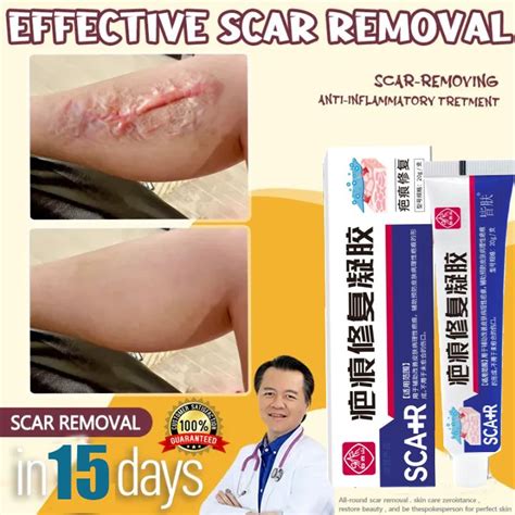 Scar Remover For Old And New Scar Scarminator Cream Skin Repair Cream